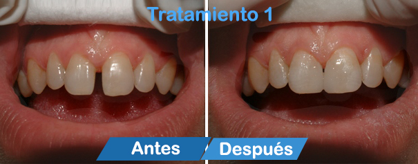 dentistas en cancun