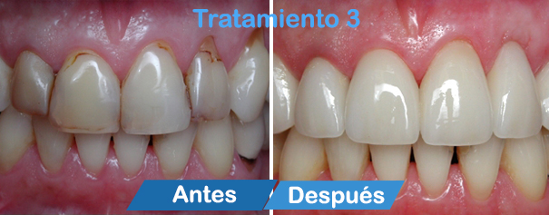 dentistas en cancun