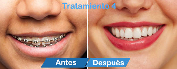 dentistas en cancun