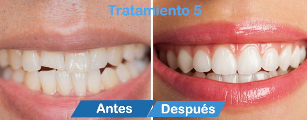 dentistas en cancun