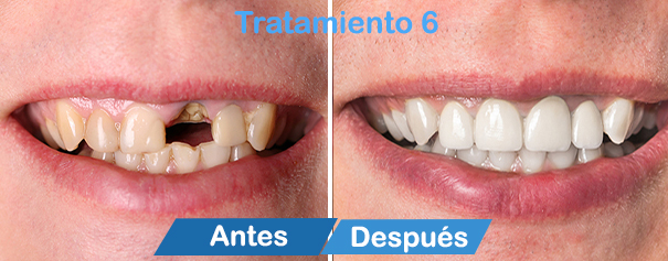 dentistas en cancun